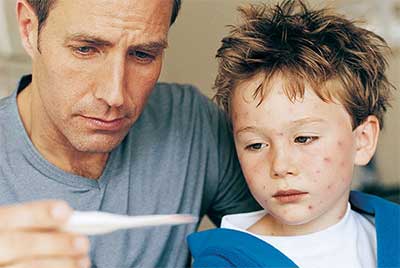 Chicken Pox Vaccine? Why You're Never Too Old | Advance ER